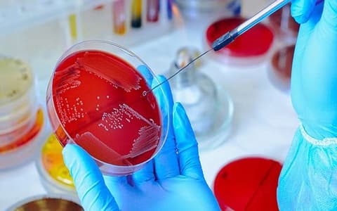Gloved hands streaking a red agar plate with a loop, other plates behind.